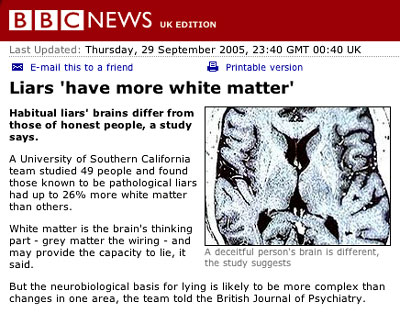 bbcbrain.jpg