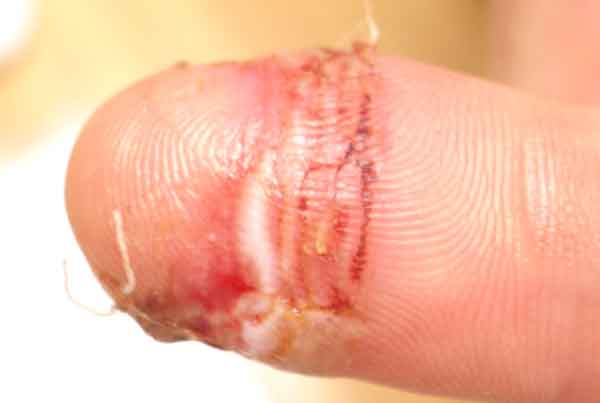 finger.jpg